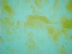 yellow algae in pool